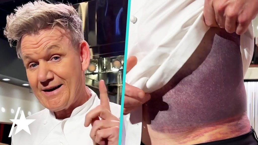 Gordon Ramsay Bike Accident – Latest Update